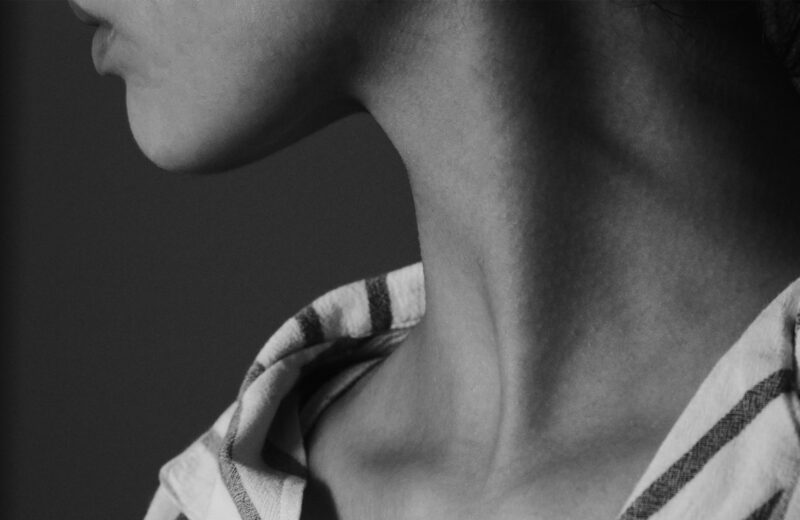 Black-and-white close-up of a person’s neck and jawline, with their head tilted upward and a striped shirt visible at the shoulders.