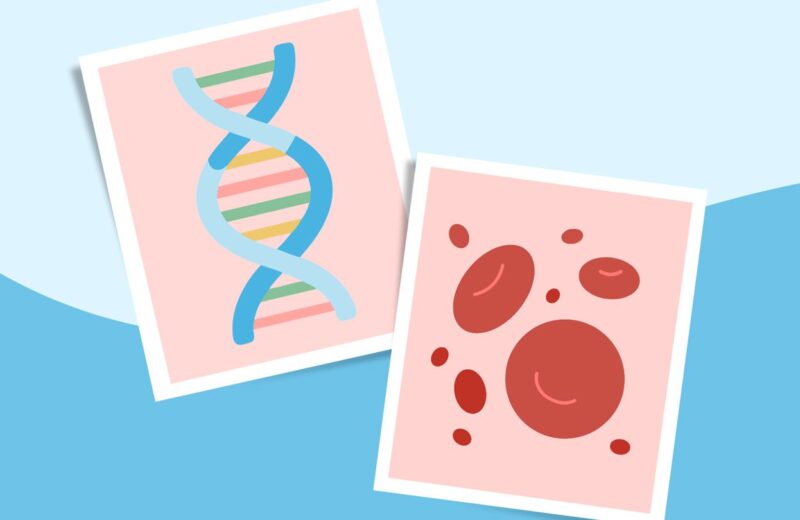 Rosacea Causes and Triggers