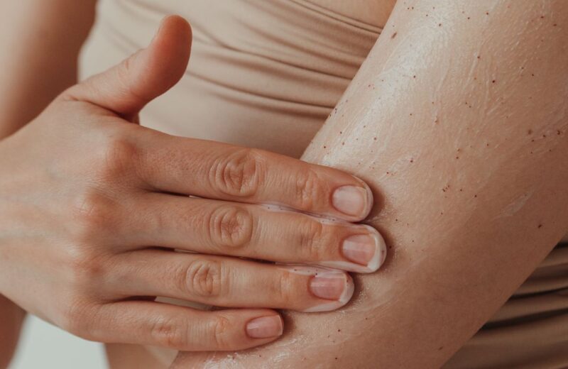 10 Beauty Products and Treatments That Can Trigger a Psoriasis Flare